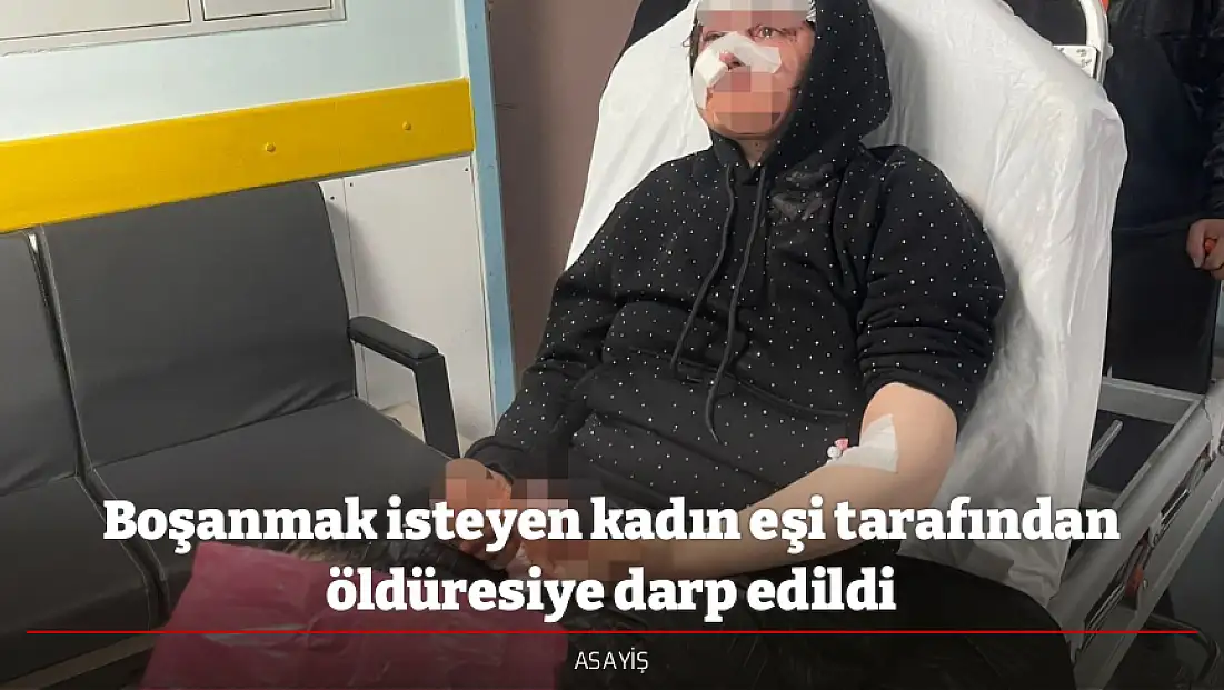 Boşanmak isteyen kadın eşi tarafından öldüresiye darp edildi