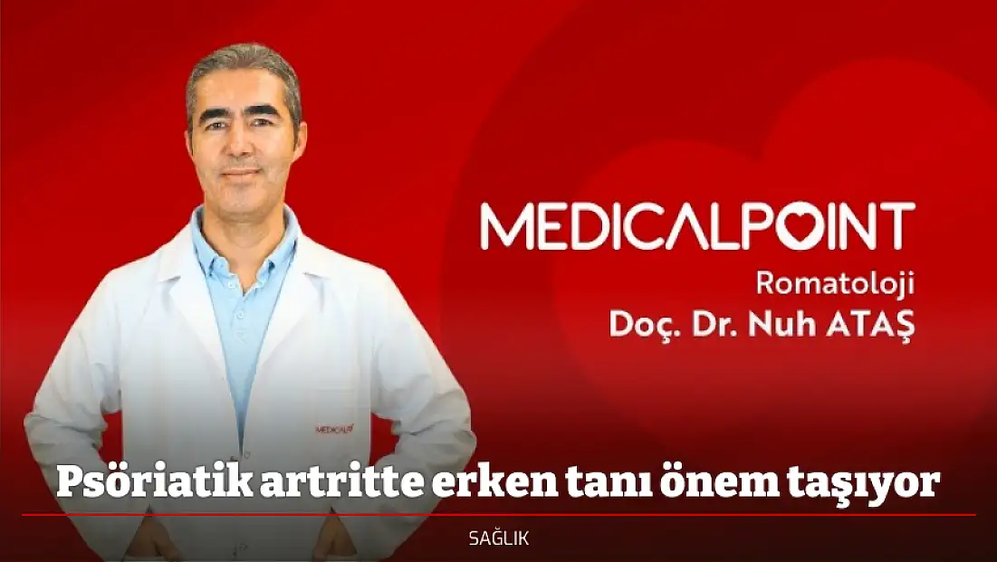 Psöriatik artritte erken tanı önem taşıyor