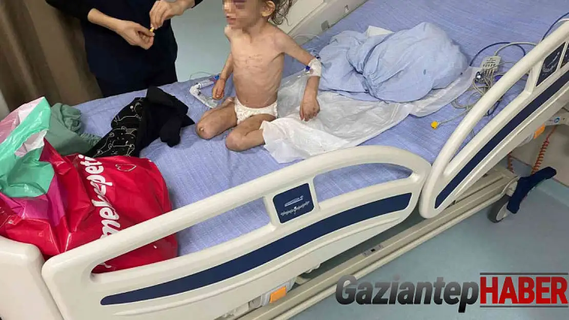 Gaziantep'te anne, 5 yaşındaki çocuğuna günlerce işkence ederek aç bıraktı