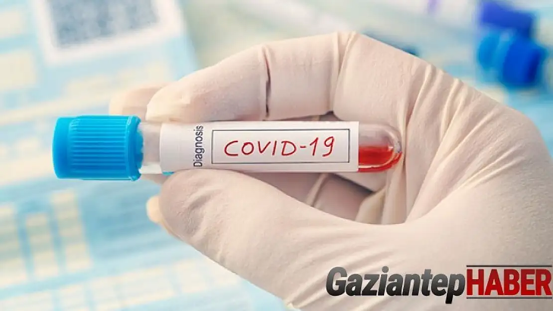 Covid-19 aşısının üretimine başlandı