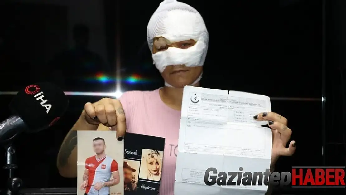 7 saat işkence edilen kadının kafasında 4 şişe kırıldı