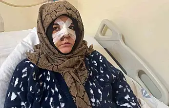 Kocasının öldüresiye darp ettiği kadın dehşet anlarını anlattı: 'Yoldan geçen vatandaş olmasaydı ölmüştüm'