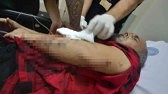 11 aylıkken pitbull saldırısına uğrayan minik Sadrettin, anne kelimesinden önce 'acıyor'u öğrendi