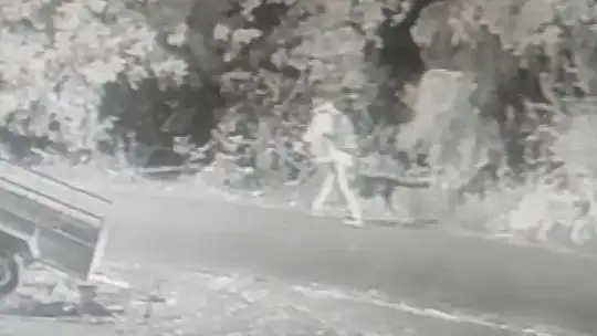 11 aylıkken pitbull saldırısına uğrayan minik Sadrettin, anne kelimesinden önce 'acıyor'u öğrendi