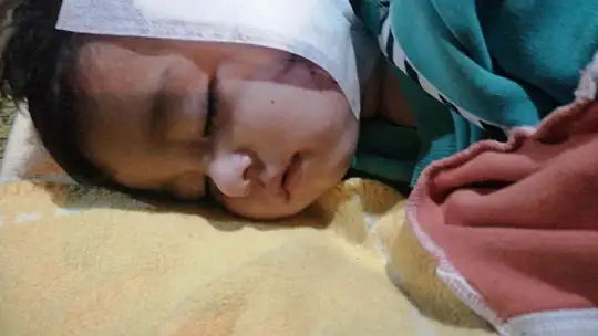 11 aylıkken pitbull saldırısına uğrayan minik Sadrettin, anne kelimesinden önce 'acıyor'u öğrendi