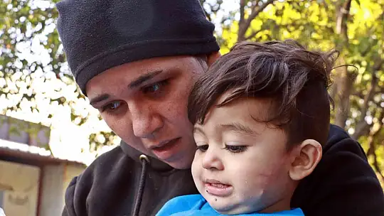 11 aylıkken pitbull saldırısına uğrayan minik Sadrettin, anne kelimesinden önce 'acıyor'u öğrendi