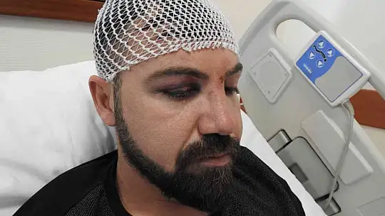 15 kişi tek kişiye saldırdı, araya girenlere bıçak çektiler