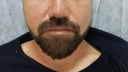 15 kişi tek kişiye saldırdı, araya girenlere bıçak çektiler