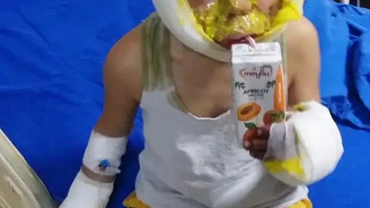 4 çocuğun mazot dolu tenekeyle oyunu faciayla bitti