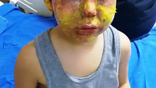 4 çocuğun mazot dolu tenekeyle oyunu faciayla bitti