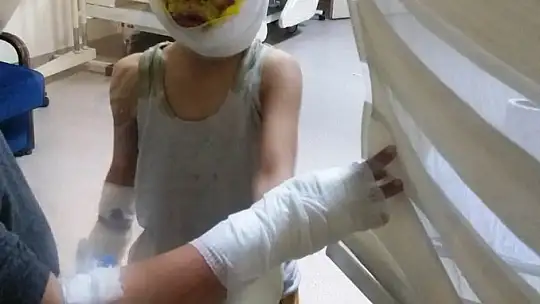 4 çocuğun mazot dolu tenekeyle oyunu faciayla bitti