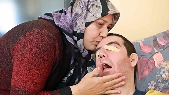 8 yıldır gözlerini kırpamıyor, adeta kan ağlıyor