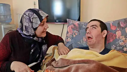 8 yıldır gözlerini kırpamıyor, adeta kan ağlıyor
