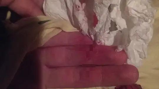Asansörde bıçaklı taciz davasının ilk duruşması görüldü