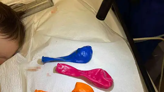 Bebeğin midesinden 3 balon çıktı