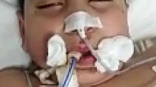 Elektrik çarpmasıyla komalık oldu, bir yıl sonra aynı gün hayatını kaybetti