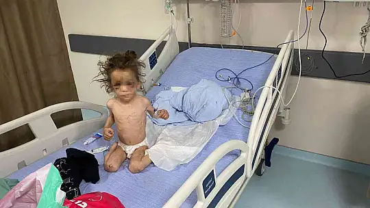 Gaziantep'te anne, 5 yaşındaki çocuğuna günlerce işkence ederek aç bıraktı
