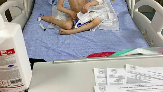 Gaziantep'te anne, 5 yaşındaki çocuğuna günlerce işkence ederek aç bıraktı