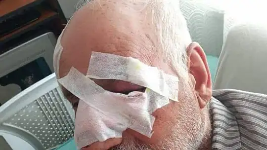 Gaziantep'te köpeklerin saldırdığı 1 kişi öldü