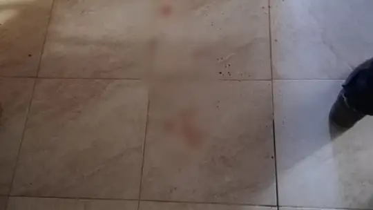 Gaziantep'te site yöneticisi kadına bıçaklı saldırı