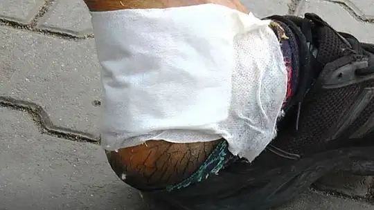 Gaziantep'teki ikinci pitbull saldırısında 2 şahıs gözaltına alındı