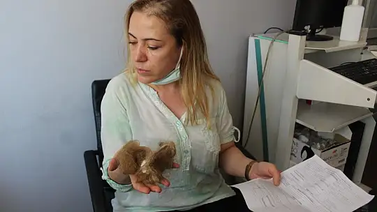 Hemşirenin saçını yolan şüpheli serbest bırakıldı