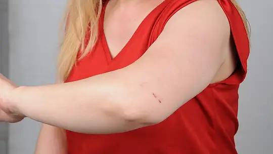 Kadın hasta, hemşireye önce küfürler savurdu, sonra da saçlarını yoldu
