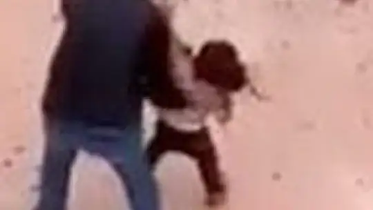 Pitbull saldırısına uğrayan Asiye, Antalya'ya sevk edildi
