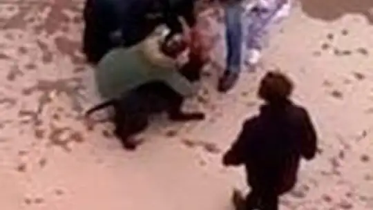 Pitbull saldırısına uğrayan Asiye'nin görüntüleri tepki topladı