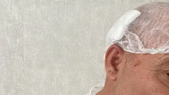 Saç ektirmek için gittiği hastaneden cenazesi çıktı