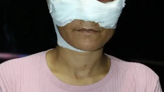 7 saat işkence edilen kadının kafasında 4 şişe kırıldı