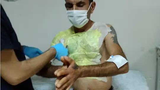 Tıkanan lavaboyu açmak isterken canından oluyordu