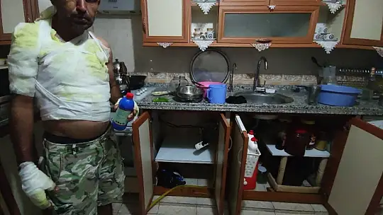 Tıkanan lavaboyu açmak isterken canından oluyordu
