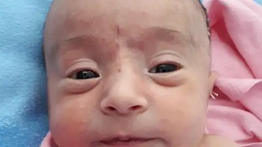 Yaşamaz denilen Buğlem bebek hayata tutundu