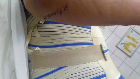 Yengesini tehdit etti, üzerine araç sürdü yetmedi baltayla saldırdı