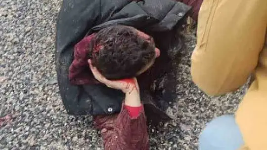 Yolda yatan yaralı ile yardıma gelenler arasında ilginç diyalog