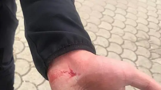 Gaziantep'te zabıta ekiplerine sopalı bıçaklı saldırı:2 yaralı