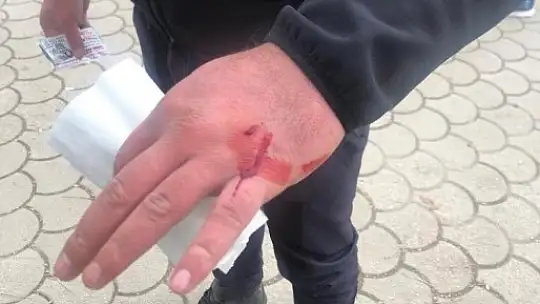 Gaziantep'te zabıta ekiplerine sopalı bıçaklı saldırı:2 yaralı