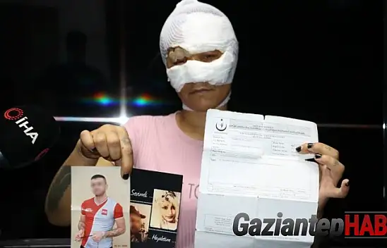 7 saat işkence edilen kadının kafasında 4 şişe kırıldı