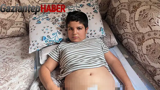 Şanlıurfa'da sokak köpeklerinin saldırdığı çocuk dehşet dolu anlar yaşadı