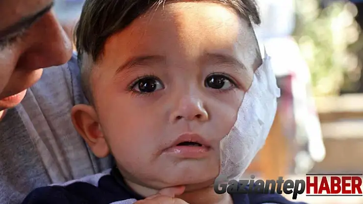 11 aylıkken pitbull saldırısına uğrayan minik Sadrettin, anne kelimesinden önce 'acıyor'u öğrendi