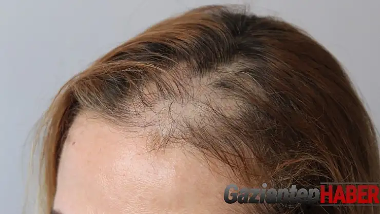 Hemşirenin saçını yolan şüpheli serbest bırakıldı