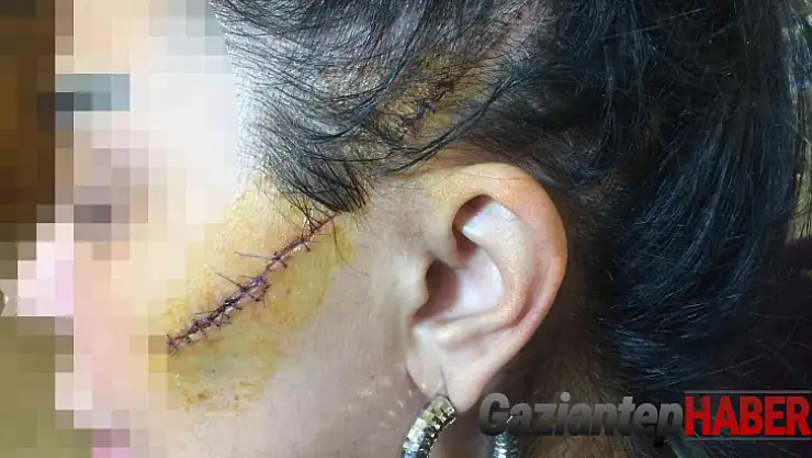 Saplantılı aşık dehşeti