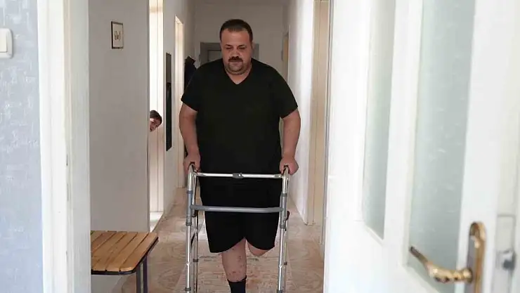 Terapi sonrası felaket: Tedavi için gitti, ayağı kesildi