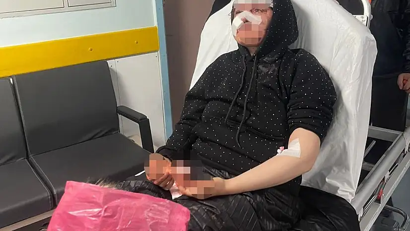 Boşanmak isteyen karısını öldüresiye darp eden koca tutuklandı