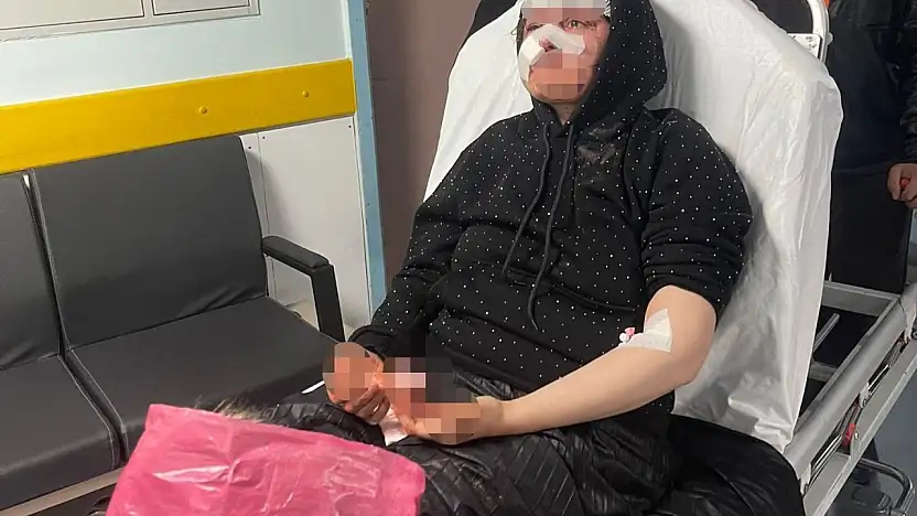 Boşanmak isteyen karısını öldüresiye darp eden koca tutuklandı