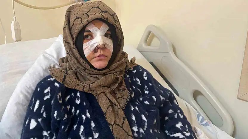 Kocasının öldüresiye darp ettiği kadın dehşet anlarını anlattı: 'Yoldan geçen vatandaş olmasaydı ölmüştüm'