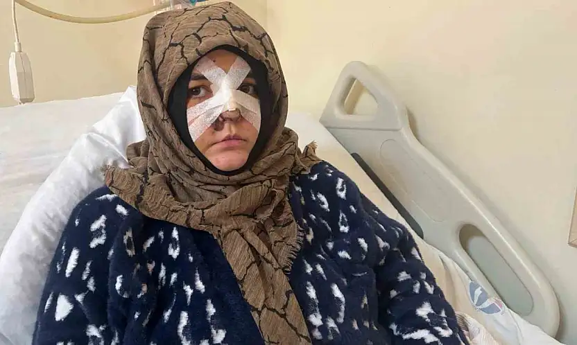 Kocasının öldüresiye darp ettiği kadın dehşet anlarını anlattı: 'Yoldan geçen vatandaş olmasaydı ölmüştüm'